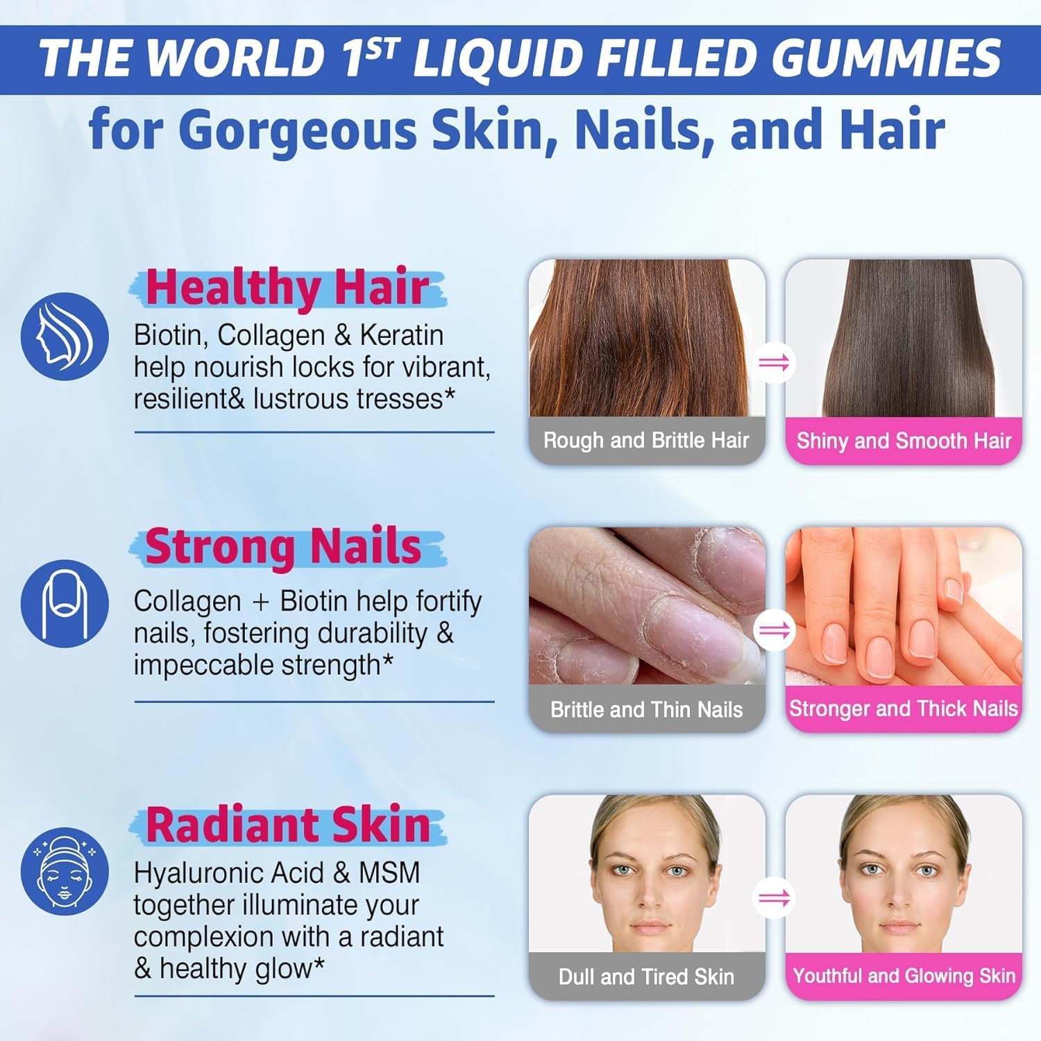 Women's Sugar-Free Biotin Gummies with Multi Collagen for Hair Skin Nails - 10000mcg Biotin, Hydrolyzed Collagen, Keratin, Hyaluronic Acid - Hair Growth Vitamins
