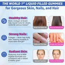 womens-sugar-free-biotin-gummies-with-multi-collagen-for-hair-skin-nails-10000mcg-biotin-hydrolyzed-collagen-keratin-hyaluronic-acid-hair-growth-vitamins-06-womens-sugar-free-biotin-gummies-with-multi-collag-6.jpg